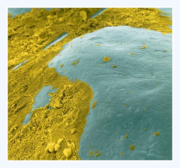 Plaque (bakteriebelægninger) på tandoverflade.
©Tandlæge Jakob Kihl