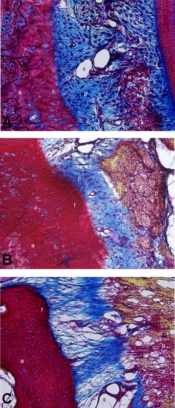 Parodontal ligament
© Tandlæge Jakob Kihl | Lyngby