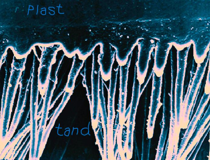 Eksempel på binding af plast (øverst) med tand (nederst) med tyndtflydende plast (bonding), der flyder ind i de små kanaler (dentintubuli) i tandbenet (dentin)