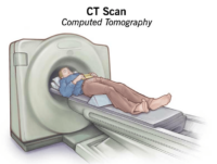 Medicinsk CT-scanning : Patient ligger ned på bevægelig slæde, og en eller flere rækker af røntgendetektorer bevæger sig i en cirkel flere gange rundt om det område, der skal afbildes.